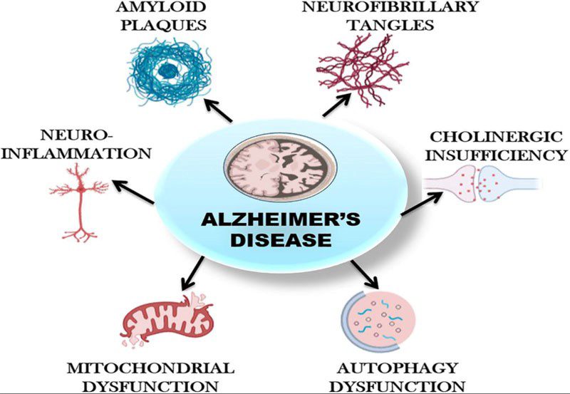 Alzheimer's Disease Treatment