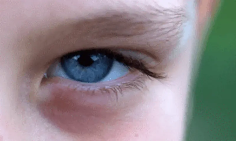 Colour of The Eyes| Parental Genes